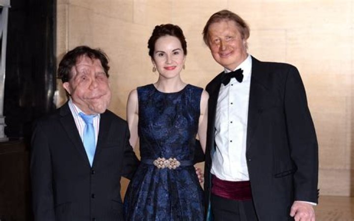 Exploring the Life of Adam Pearson and His Wife: A Journey of Love and Resilience