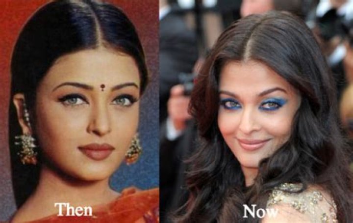 Aishwarya Rai Plastic Surgery: The Truth Behind Her Transformation