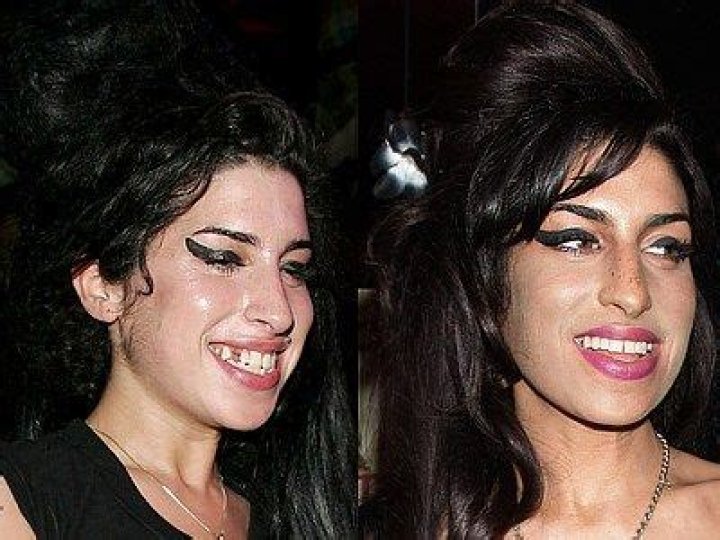 Amy Winehouse's Teeth: A Unique Reflection of Her Life and Legacy