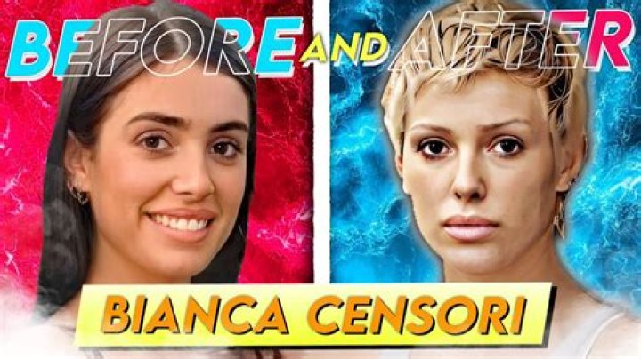 Bianca Censori Chirurgie: A Comprehensive Exploration