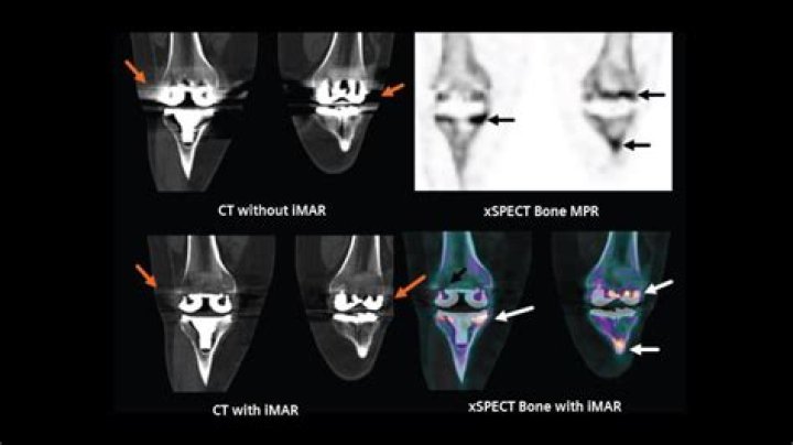 CCB CT Scan: Comprehensive Diagnostic Imaging
