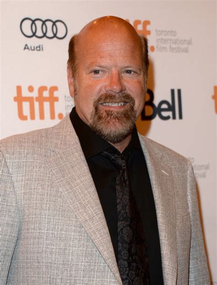 Did Rex Linn Get His Teeth Fixed? Exploring the Transformation