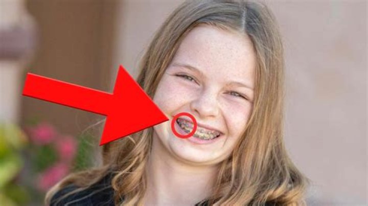 Does Salish Matter Have a Lisp? Unveiling the Truth Behind Her Speech