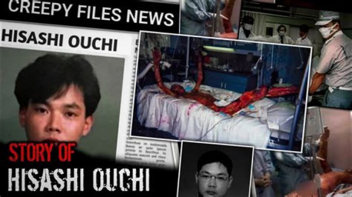 Hisashi Ouchi Real Photo: The Story Behind the Tragic Incident