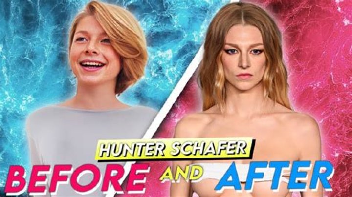 Hunter Schafer Nose Job: Exploring the Transformation and Impact
