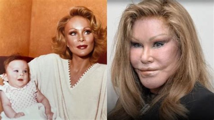 Unveiling the Mystique: Jocelyne Wildenstein Before Surgery