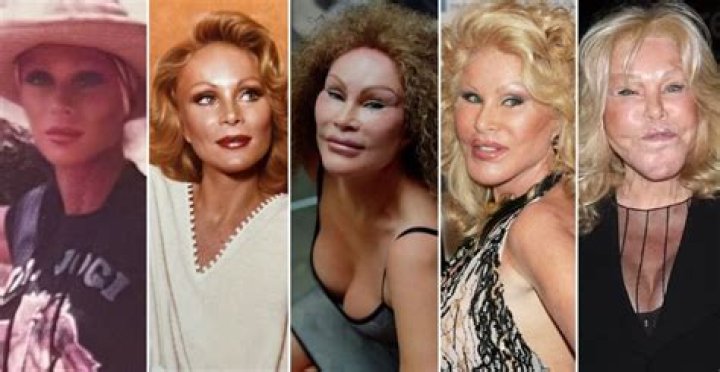 Unveiling the Life of Jocelyne Wildenstein: The Catwoman of New York