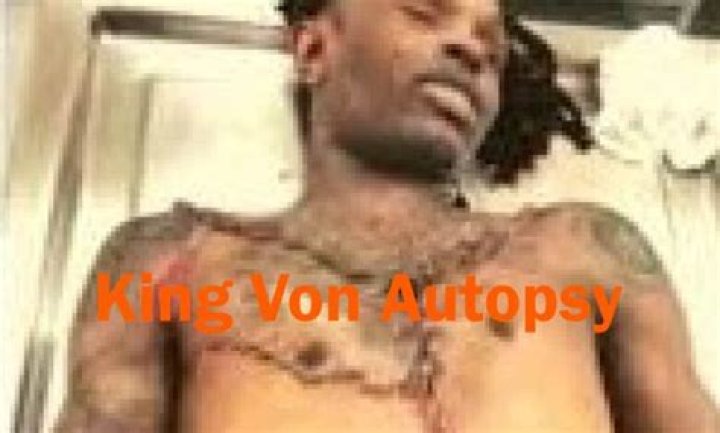 Understanding King Von's Autopsy: A Deep Dive into His Life and Legacy