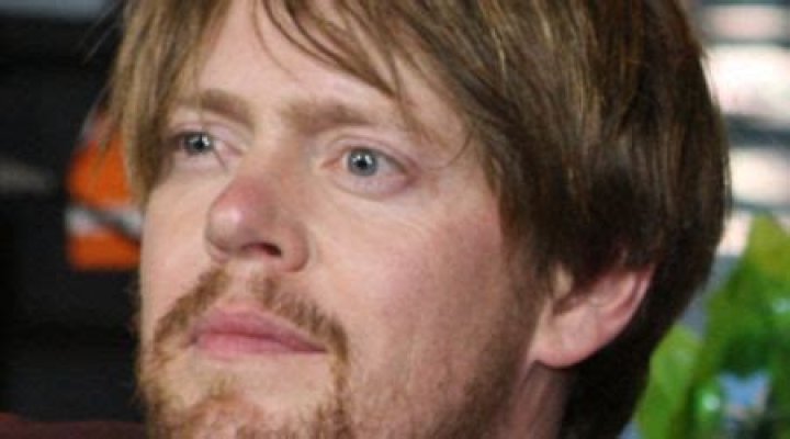 Kris Marshall Face Surgery: A Comprehensive Look into the Star's Journey