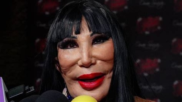 Lyn May Botched: A Comprehensive Look Into the Controversy