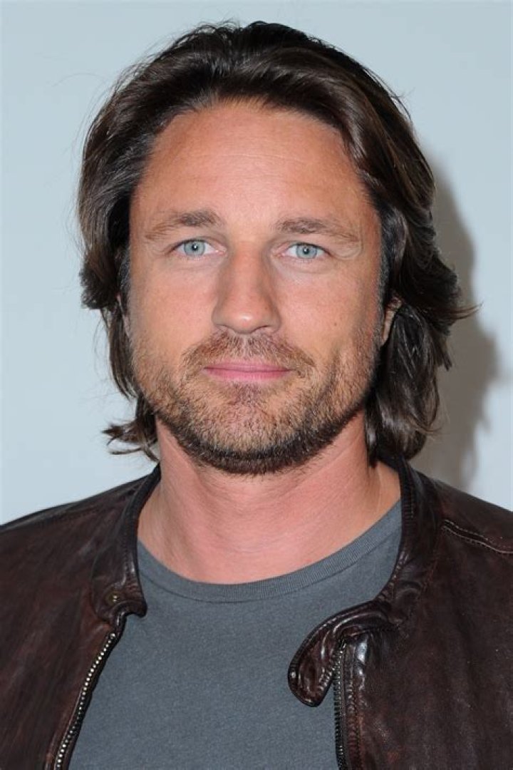 Martin Henderson Face Surgery: The Truth Behind the Transformation