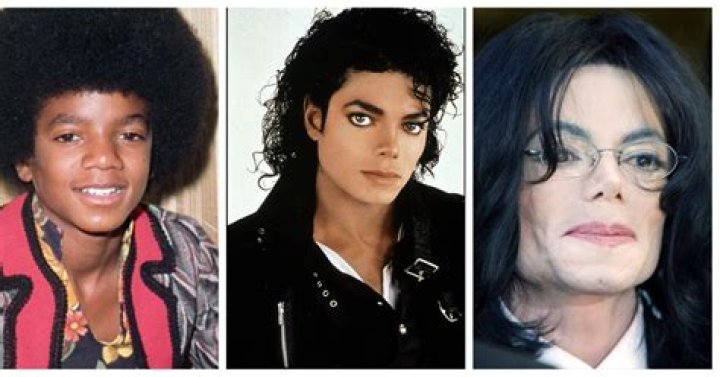 Michael Jackson Skin Disease: Unveiling the Truth Behind the Icon's Condition