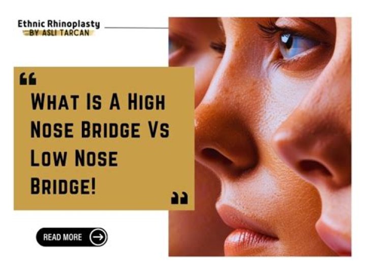 Nose Bridge Aesthetic: Understanding Its Look and Significance