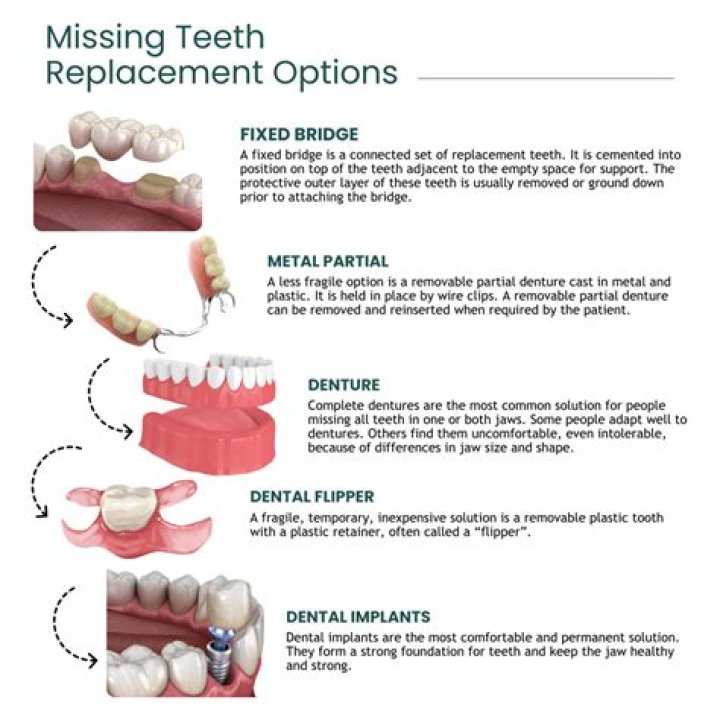 Temporary Replacement for 2 Hungry: Exploring Solutions to Satisfy Your Appetite