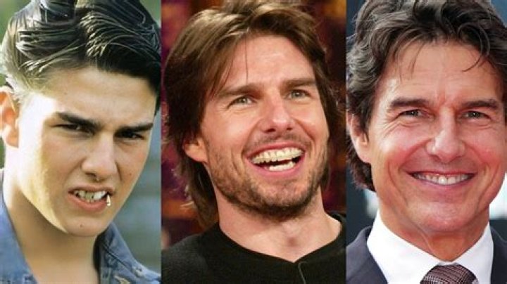 Tom Cruise Teeth: The Story Behind His Iconic Smile