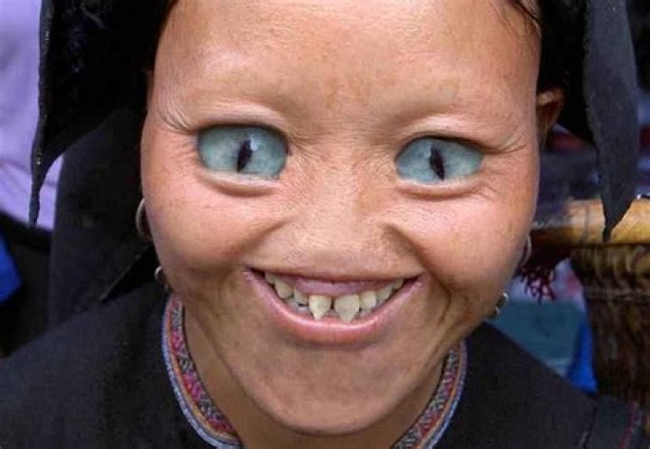 Ugliest Lightskin in the World: A Deep Dive into Beauty Standards and Perceptions