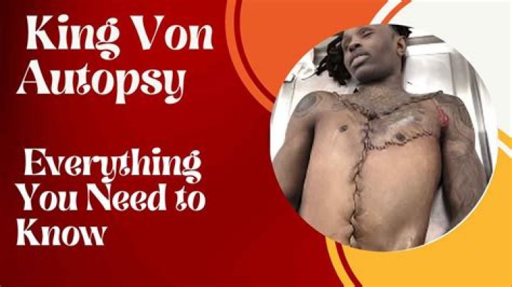 Unveiling the Mysteries: The Intriguing Case of Von Autopsy