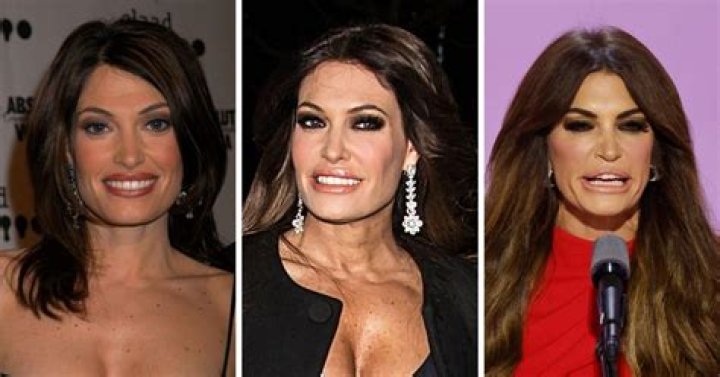 What Happened to Kimberly Guilfoyle: A Comprehensive Overview
