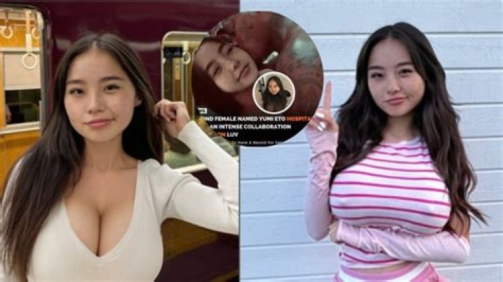 Yumi Eto Hospitalized: The Story Behind the Headlines